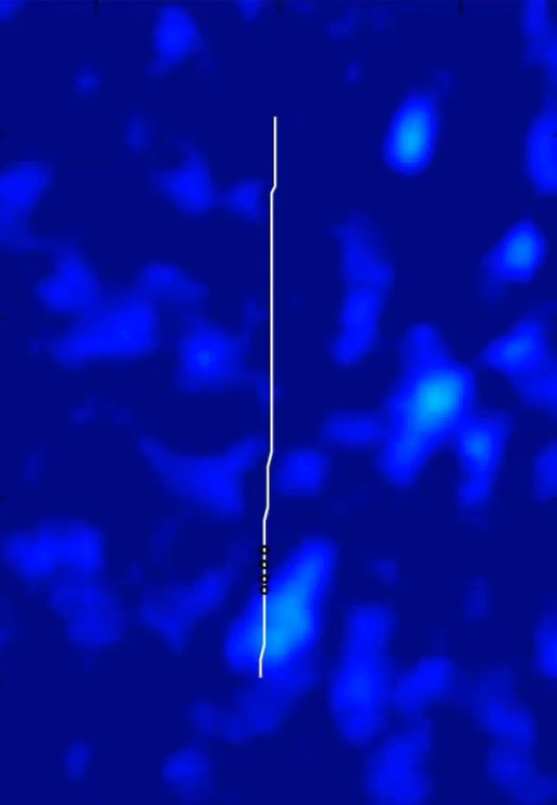 Time-lapse PFI images of activity around a well during injection